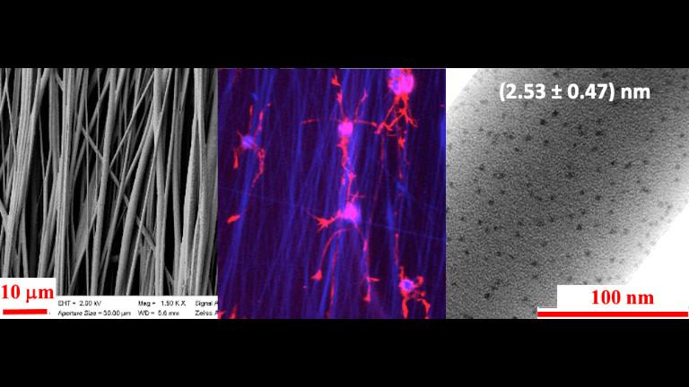 Nanoestruturas para a Engenharia de Tecidos